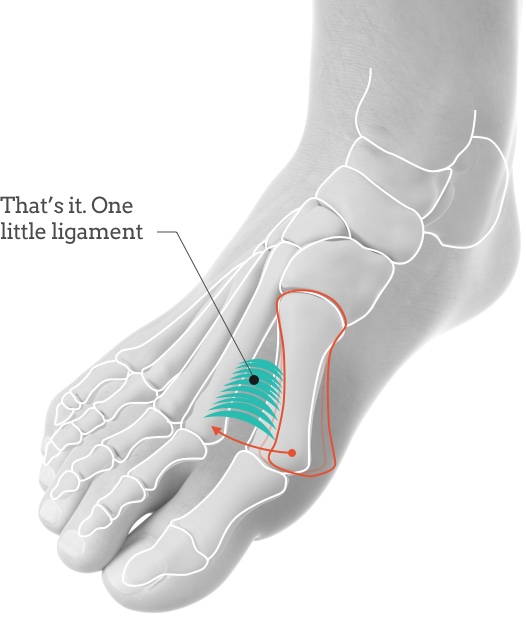 Bunions Cause Symptoms and Treatment options